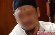 TANDA HITAM PADA DAHI MUSLIM, APAKAH BAIK?