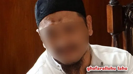 TANDA HITAM PADA DAHI MUSLIM, APAKAH BAIK?